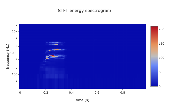 STFT log spectrogram